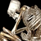 Reconstrucción tridimensional por tomografía computarizada de los restos momificados del minero prehispánico de Atacama, en posición flectada, con fracturas visibles en costillas y columna