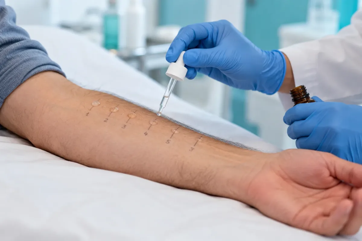 prick-test-alergias-portada-cedimed-1200x800.webp