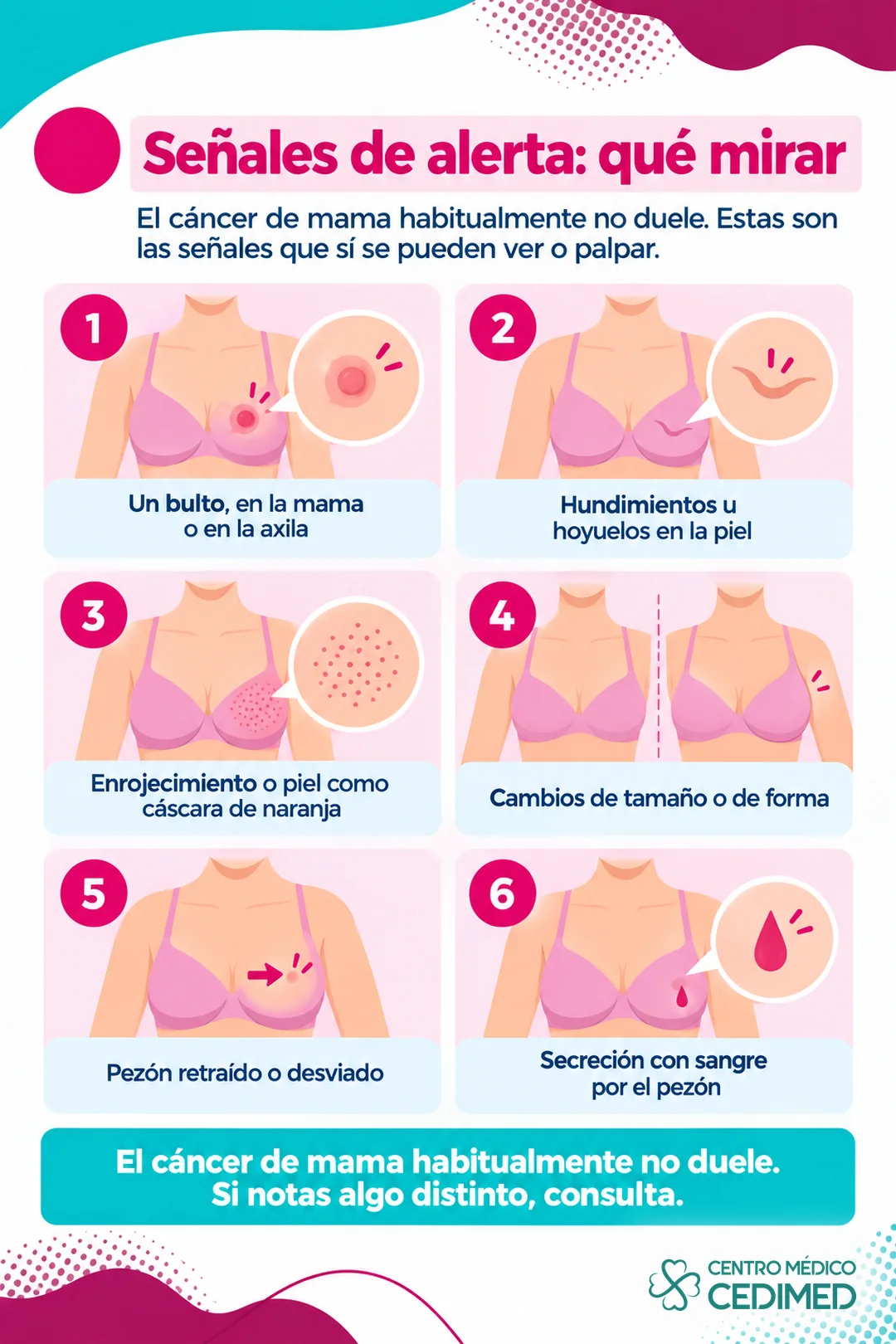 Infografía de las seis señales de alerta en la mama: un bulto en la mama o la axila, hundimientos en la piel, enrojecimiento o piel como cáscara de naranja, cambios de tamaño o forma, pezón retraído o desviado y secreción con sangre por el pezón
